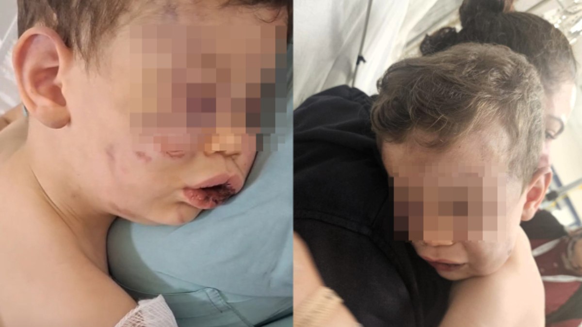 Denizli’de 2 yaşındaki bebeğe vahşeti yaşatan anne ile sevgilisi gözaltında